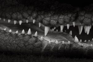 切らないリフトアップの危険性は本当にある？